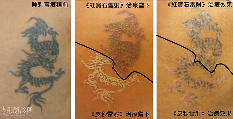 6刺青案例02.jpg