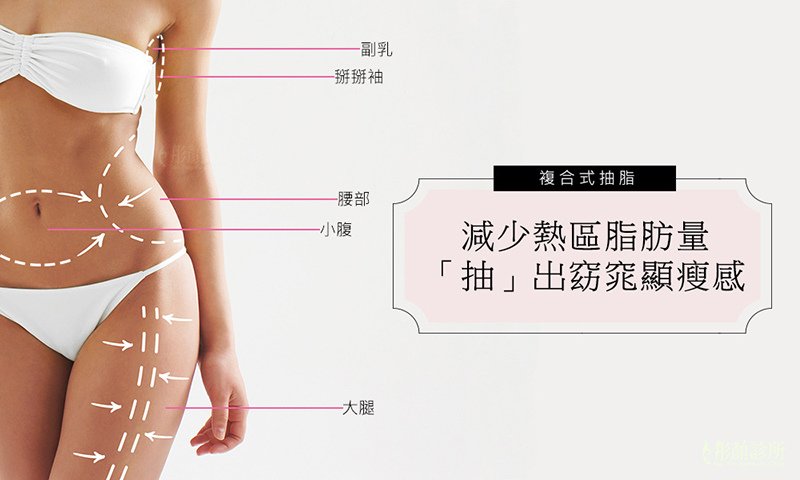 彤顏診所-桃園中壢-抽脂-瘦手臂-複合式抽脂