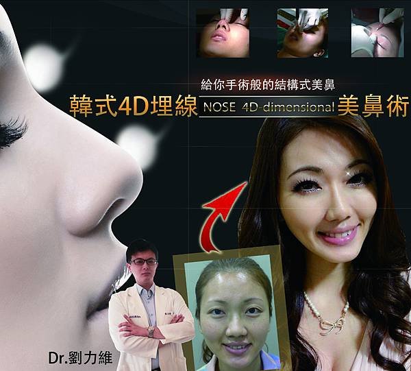 4D隆鼻淑韻重製