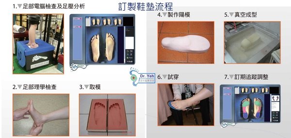 矯正鞋墊,訂做鞋墊,手工鞋墊,取模,dr.yeh,