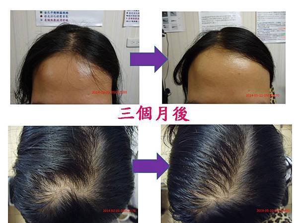 阿咪3 months