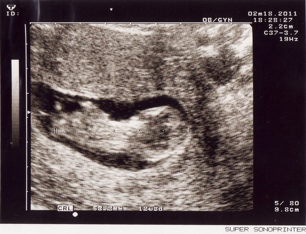 11W1D