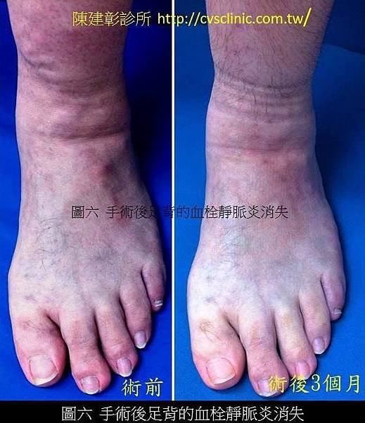 投影片7