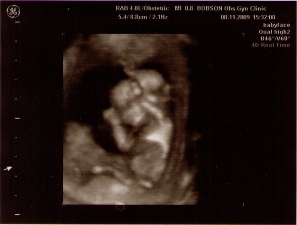 12w6d