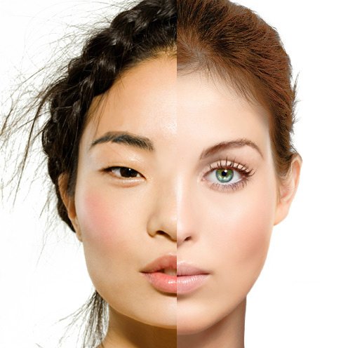 Rhinoplasty-VS-Asian-Rhinoplasty