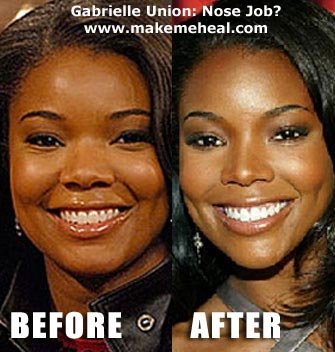 Gabrielle-union-nose-job