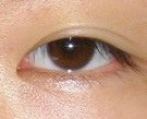 lu-ptosis-1-rev