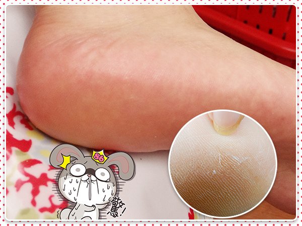 夾腳拖_穿搭_美足_足膜_老廢角質_去角質_DIY_手作19.jpg