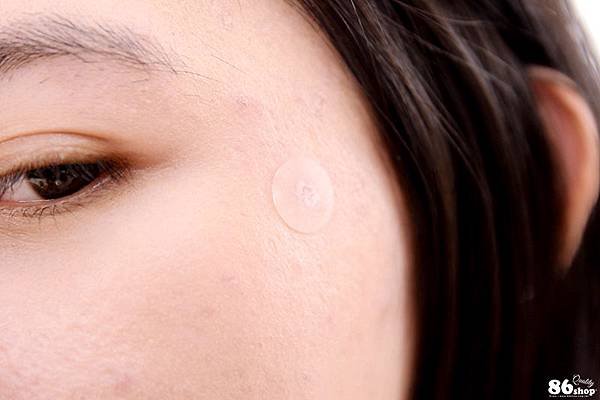 INNERSKIN 痘痘貼 痘痘隱形 超薄透氣 隔絕髒汙 吸分泌物