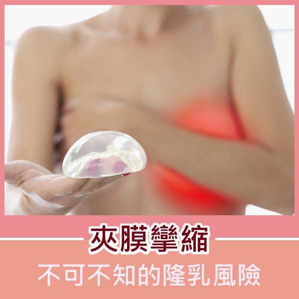 文案FB-2022051.jpg