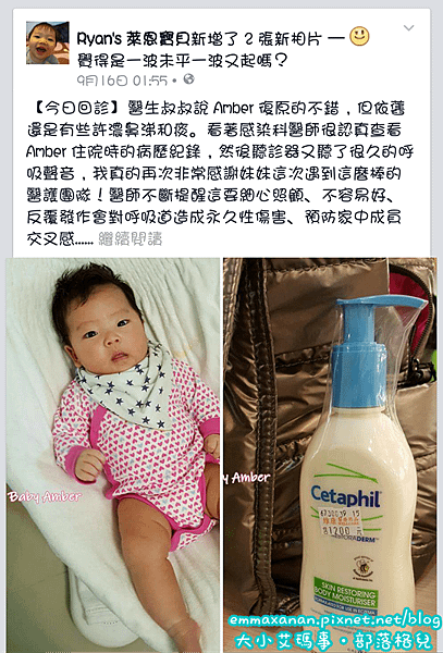 Amber 呼吸道融合病毒
