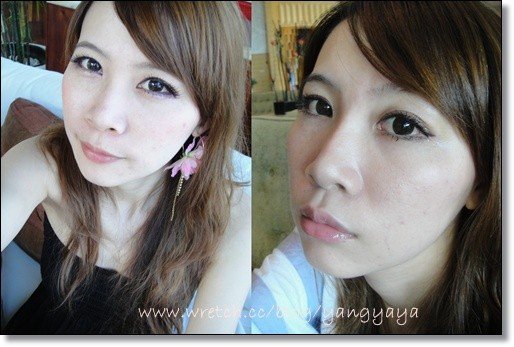 元和雅高雄台南診所微晶瓷隆鼻案例照片-yaya-5.jpg