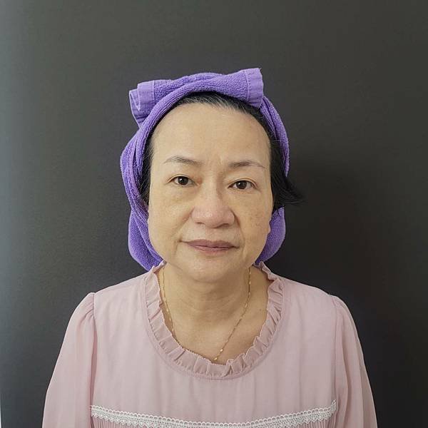 【板橋醫美】跟垂垂嘴邊肉說拜拜 HIPRO-S龍捲風音波拉提 - 愛爾麗板橋分店 (1).jpg