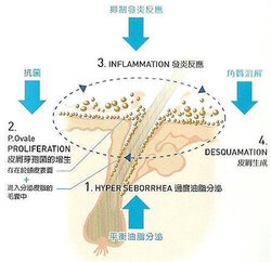 20110708頭皮削.jpg