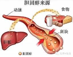 「美國政府修改了40年以來的錯誤：膽固醇有益無害，不再分好壞」的圖片搜尋結果