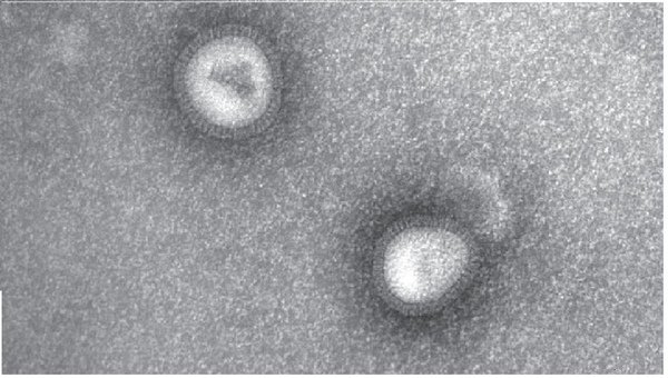 swine flu visrus 01.jpg