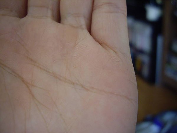 Anessa hand.JPG