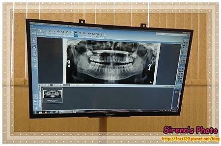康河牙醫診所-X光