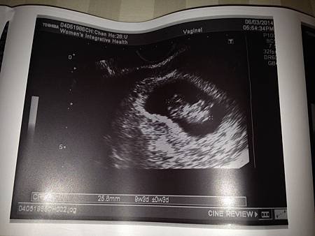 9 week
