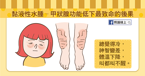 甲狀腺機能低下-07.png