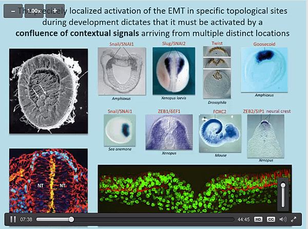 FireShot Capture 162 - Genetics of tum_ - https___hstalks.com_t_3136_genetics-of-tumor-metastasis-1_.png