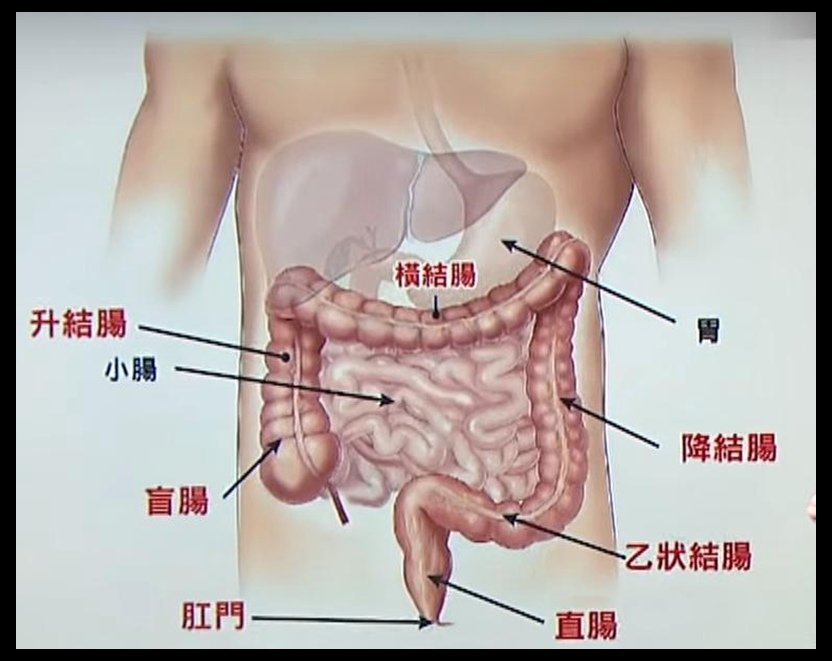 大腸癌