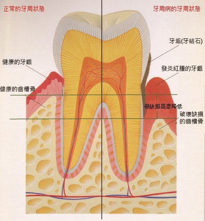 牙周對照