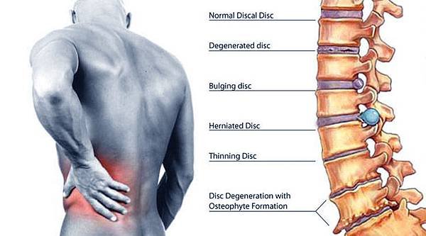 back_pain_ayurvedic_treatment