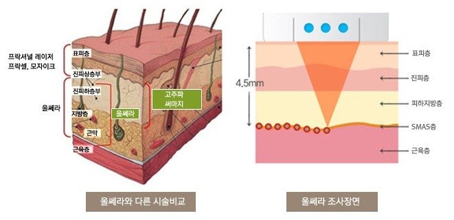 starskin_co_kr_20120723_184600