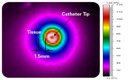 radiofrequency_infrared