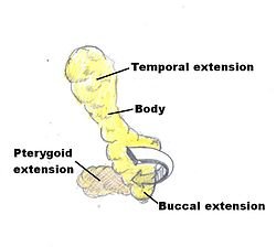 250px-Buccal_Fat_Diagram