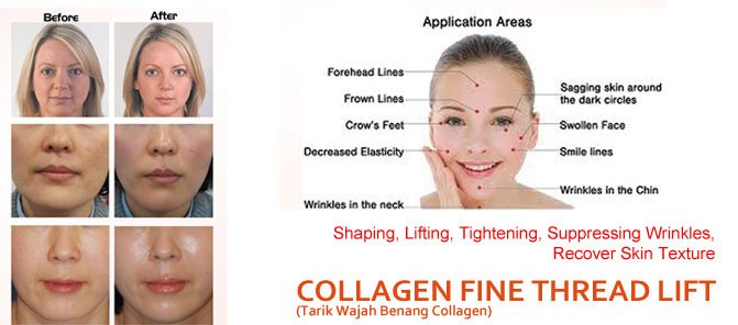 collagen_fine_thread