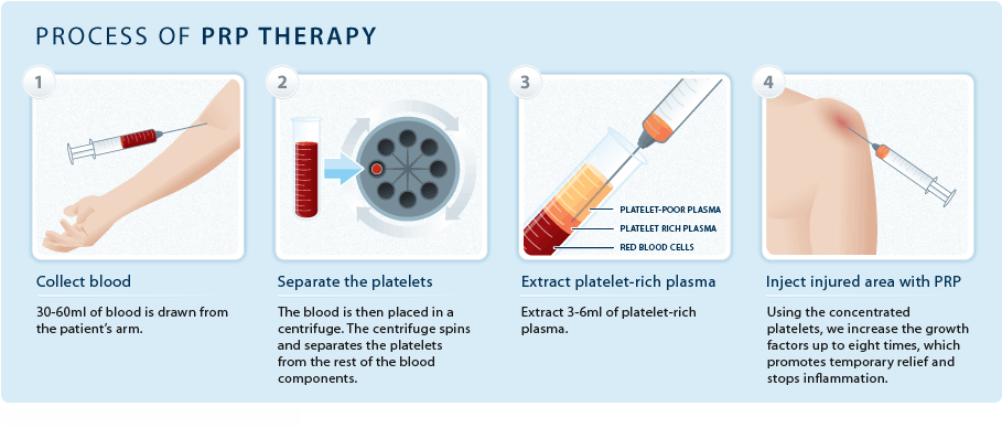 prp_process