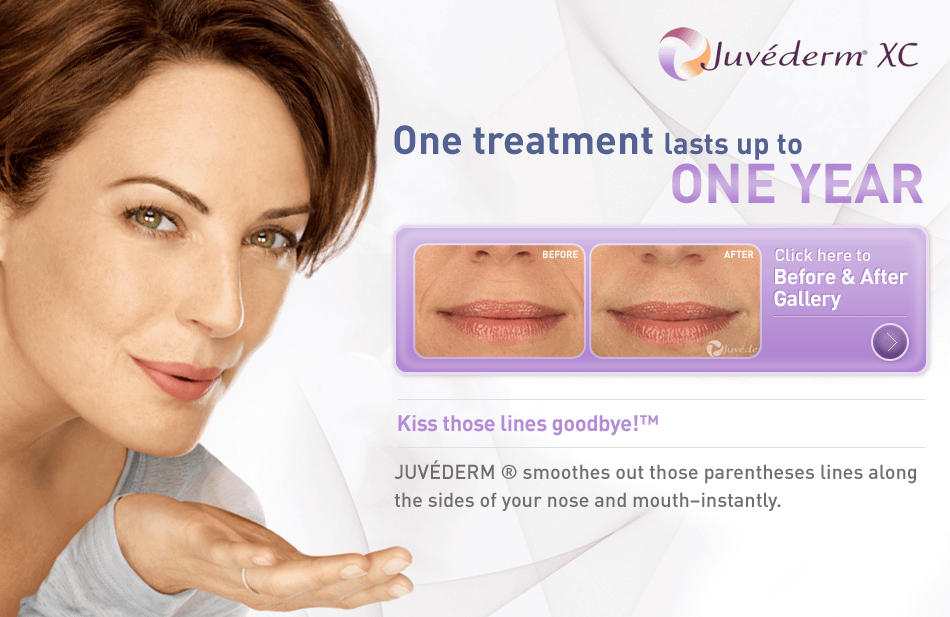 Juvederm