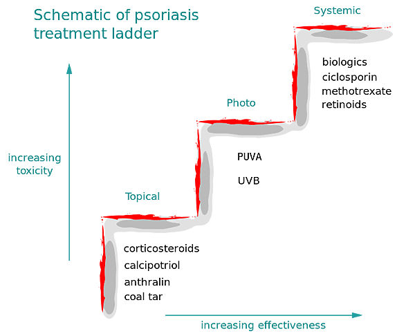 742px-Psoriasis_treatment_ladder.svg