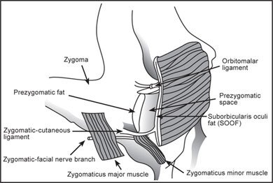 Fig4301