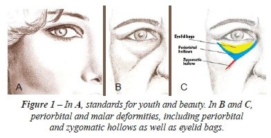 en_a13fig01