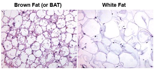 Brown-fat-to-fight-white-fat