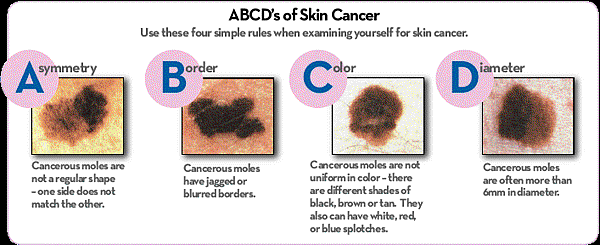 signs-of-skin-cancer