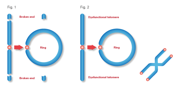 karyotype-diagram