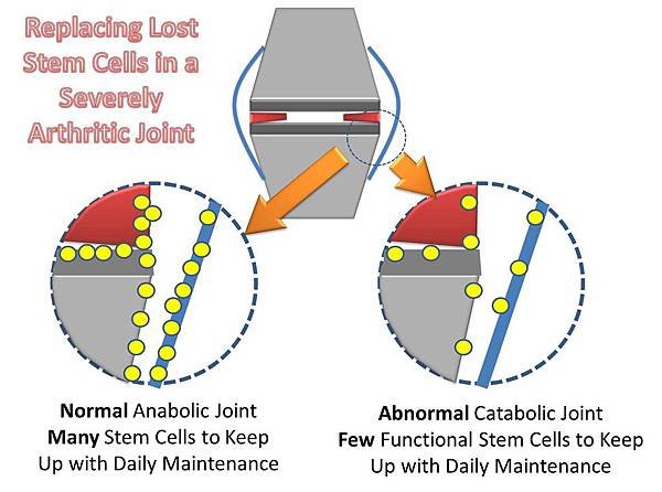 stem-cells-joint-arthritis