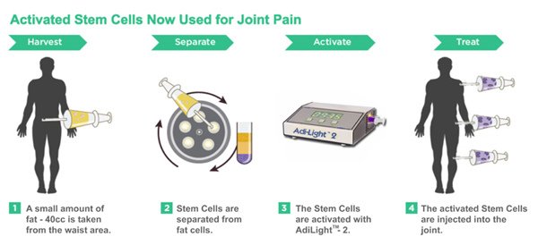 Adistem_Osteo_Stem_Cell_June_28_2012_sm2