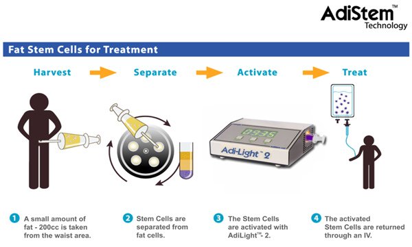 Adistem_IV_Anti-aging_July_2_2012_sm