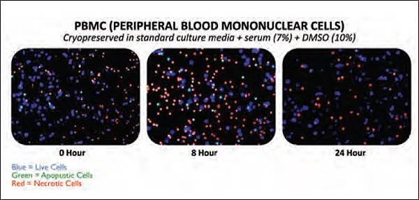 PBMC-peripheral-blood-mononuclear-cells