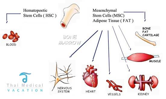 MSC-adipose-stem-cells-vs-Bone-Marrow-thai-medical-vacation