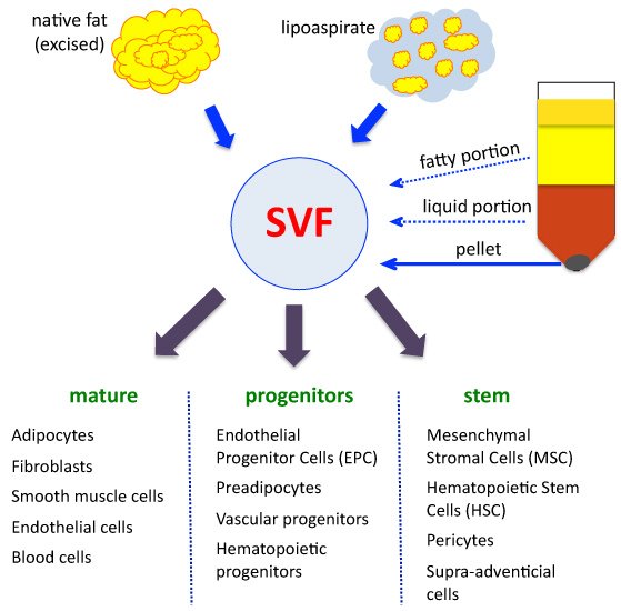 SVF