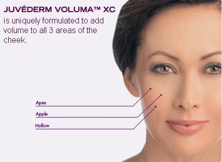 voluma-placement-loudoun-copy