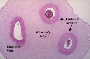 umbilicalcord-crosssection3