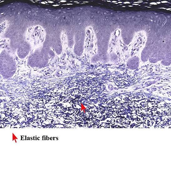 normal_skin_with_stain_for_elastic_fibres