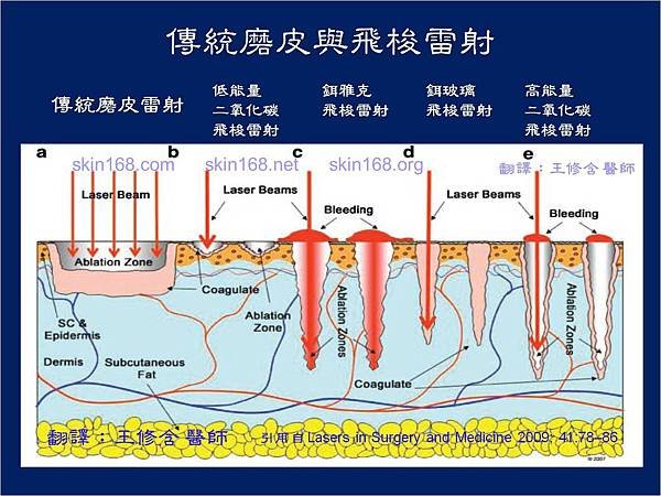 _Lasers_in_Surgery_and_Medicine_2009_41_78_86